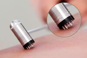 Martelletto Fior di Prugna in acciaio, strumento per massaggio e trattamento miofasciale